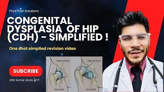 Barlow & Ortolani test, Congenital Hip Dislocation- Everything You Need To Know - Dr. Ishant Arora