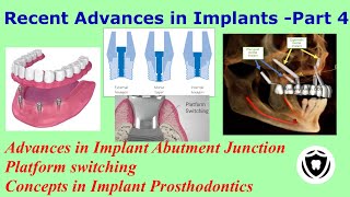 Recent Advances in Implants - Part 4