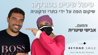 טיפולי שיניים בטורקיה עם ביונד סמייל - החיוך המושלם של אבישי