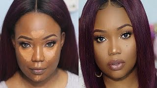 Acne/Hyper-pigmentation | Full coverage Drugstore foundation,Highlighting & Contouring routine