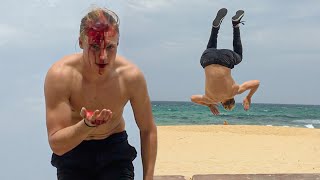 How I Split My Head Open Doing A Backflip