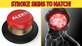 ATTENTION: 6 Stroke Signs You Can't Ignore! #stroke #health