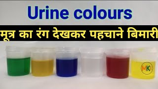 यूरिन कलर चार्ट || urine colour chart in hindi