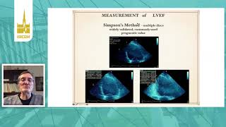 ISICEM, Hemo monitori, Left ventricular contractility assessment by echo not just LVEF, Anthony  McL