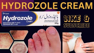 Hydrozole Cream ! Hydrozole  nappy rash and antifungil  cream ! Hydrozole cream used for in english