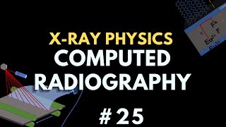 Computed Radiography (Digital Radiography) | X-ray Physics | Radiology Physics Course #32