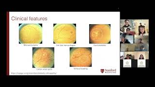 Harvard Medical AI: Dr. Brian Soetikno presents AI in Ophthalmology