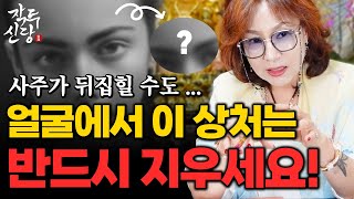 757화_상처 하나로 사주가 뒤틀려 인생이 뒤 바뀔 수도 있다? 반드시 얼굴에서 이 상처는 무조건 지우세요~!