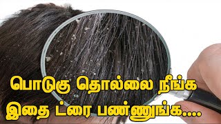 பொடுகு தொல்லை இனி இல்லை / Dandruff treatment