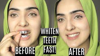 How To Whiten Your Yellow Teeth Naturally At Home | DIY TEETH WHITENING STRIPS ~ Immy