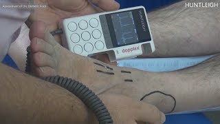 Assessment of the Diabetic Foot Video Preview