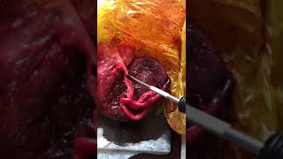 What the placenta looks like .