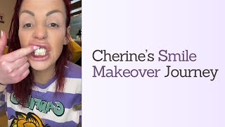 Cherine's Smile Makeover Journey At Dentistry On The Clyde︱Part 2