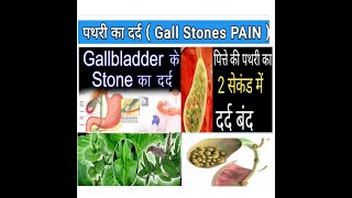 Gall Stone Colic Ki Rambaaan Medicine//Kya Aap Gall  Stone Pain Say Preshaan Hai //HM4U Roorkee.