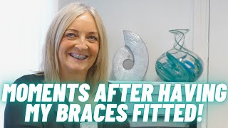 How do my NEW braces feel straight after fitting? | my six-month smile journey | ep 2