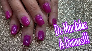 Cambio extremo | uñas mordidas con tip