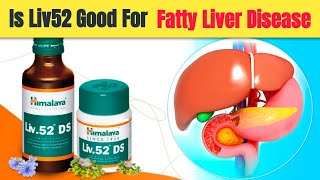 Is Liv 52 Good For Fatty Liver  | Liv 52 Tablet Benefits For Fatty liver | Fatty Liver Treatment