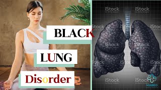 Understanding Black Lung Disease Causes, Effects, and Holistic Approaches