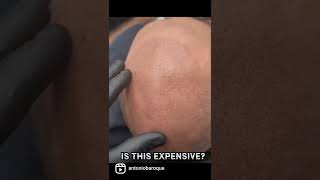 WHATS THIS ? IS THIS HAIR ? OR SMP / SCALP MICROPIGMENTATION BY ANTONIO BAROQUE