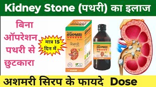 Ashmari Syrup | Ashmari Syrup के फायदे| Kidney stone treatment| पथरी का इलाज| पथरी का दर्द ठीक| UTI