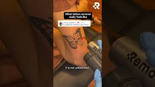 What does tattoo removal feel like?👀