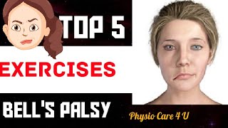 Bell's Palsy exercises & Treatment | New Exercise For Bell's palsy #pc4u