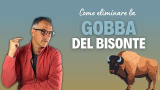 Come eliminare la GOBBA DEL BISONTE