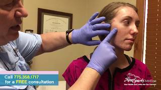 Acne Cyst Drainage Surgery for Cystic Acne - Reno Sparks MedSpa - Dr. Calvin Van Reken