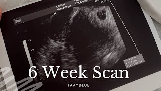 6 week Scan! Our Fertility Journey | Episode 10 | TAAYBLUE