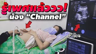 เนยท้อง 5 เดือน...รู้เพศแล้ว!! | KRK