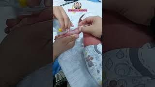 تشكيل كانيولا Cannula insertion 💉💊🩺