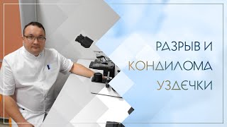 🙁 Разрыв и кондилома уздечки. Клинический случай №89