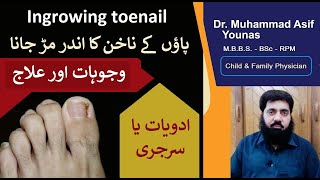 Ingrowing toenail treatment | foot nail problems solutions | how to fix ingrown toenails