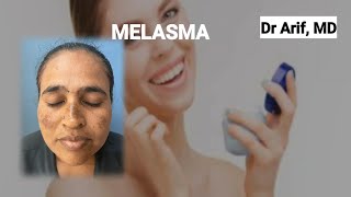 5 non-prescription creams for melasma @DrArifMDDermatologist #melasma #melasmatreatment