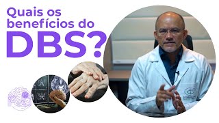 Benefícios do DBS