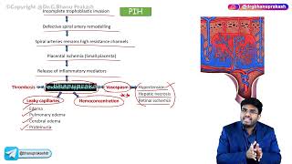 Pregnancy Induced Hypertension  ( Part -2 ) : Obstetrics and Gynecology Lectures