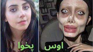 People_Who_went_too_far_with_Cosmetic_Surgeries Part 2