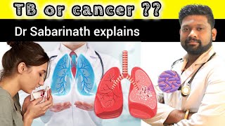 உங்களுக்கு TB-ஆ cancer-ஆ ? Dr Sabarinath Ravichandar MD DNB pulmonologist explains