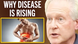 The 8 Things Causing Illness Most Doctors Can't Treat | Dr. Robert Lustig