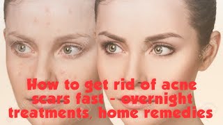 How to get rid of pimples scars fast - treatments, home remedies over night treatment