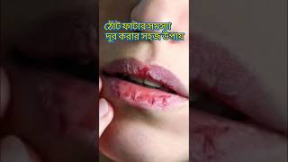 Amazing Lips care hacks | আর ঠোট ফাটবেনা #lips