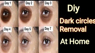 Dark circle kaise Hataye!How To Remove Dark Circles At Home Naturally #short @skindoware