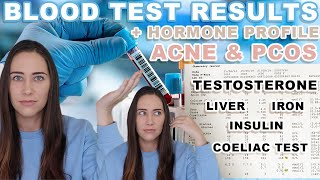 (IT'S MY LIVER!) Blood Test Results + Hormone Test for Hormonal Acne & PCOS