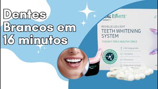 Dentes brancos em 16 minutos?