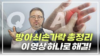 [털보의사] 방아쇠손가락 환자는 꼭 보세요. 모든 궁금증에 관한 답변 총정리