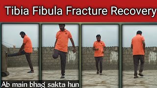 Tibia Fibula Fracture Recovery |9months 22 days ||ab limping nahi huta hai||ab me bhag sakta hun