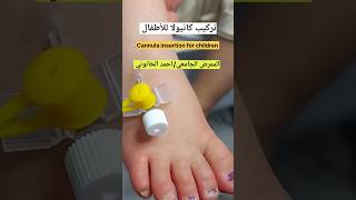 تركيب كانيولا للأطفال Cannula insertion for children