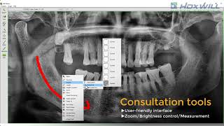 Will-Master : Patient Image Management Software