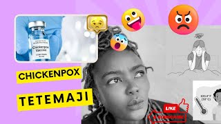 Chickenpox|| Tetemaji inasababishwa na kusambazwa vipi na Dr. Saru