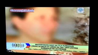 DEADLY SKIN DISEASE in PANGASINAN, BANDILA, Feb 24, 2014